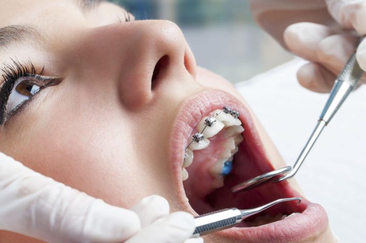 Regular Orthodontic Checkups