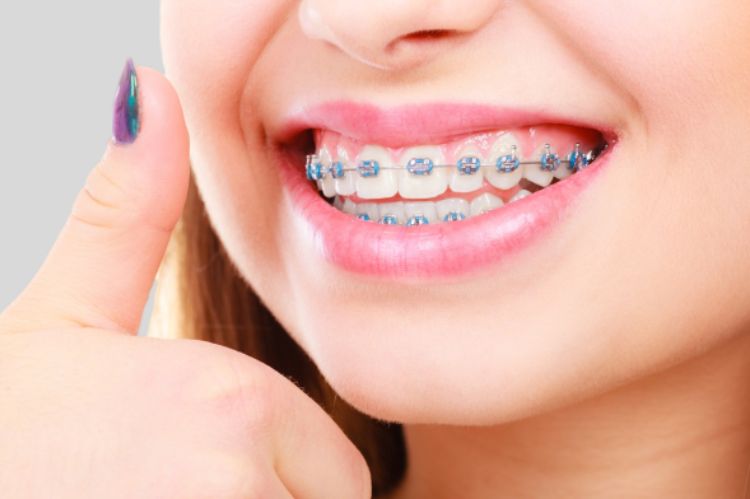 Orthodontics: A Journey towards Aesthetics and Health