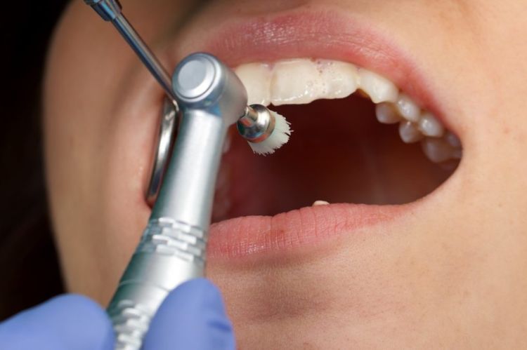 Professional Dental Cleanings and Examinations
