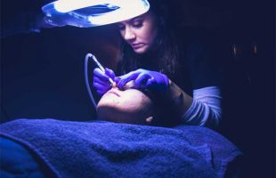 Why Everybody Is Talking About Microdermabrasion